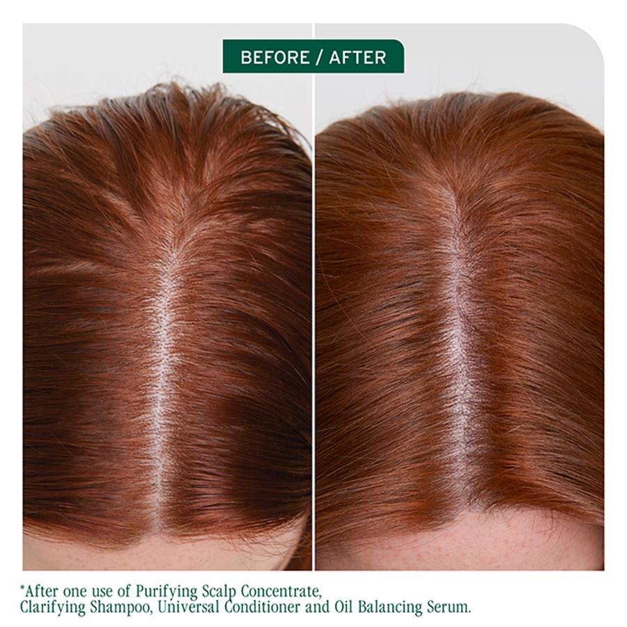 Biolage Scalp Sync Oil Balancing Serum 50ml - Image 4