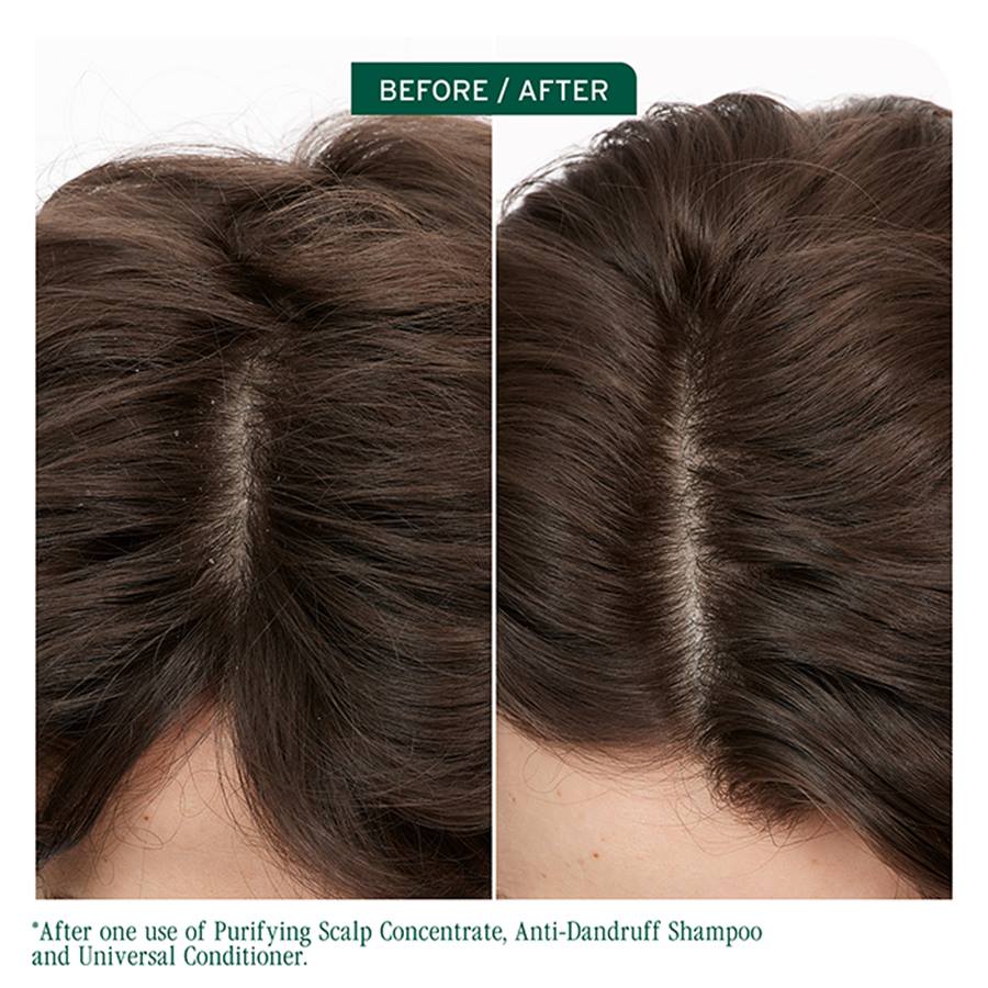 Biolage Scalp Sync Oil Balancing Serum 50ml - Image 6