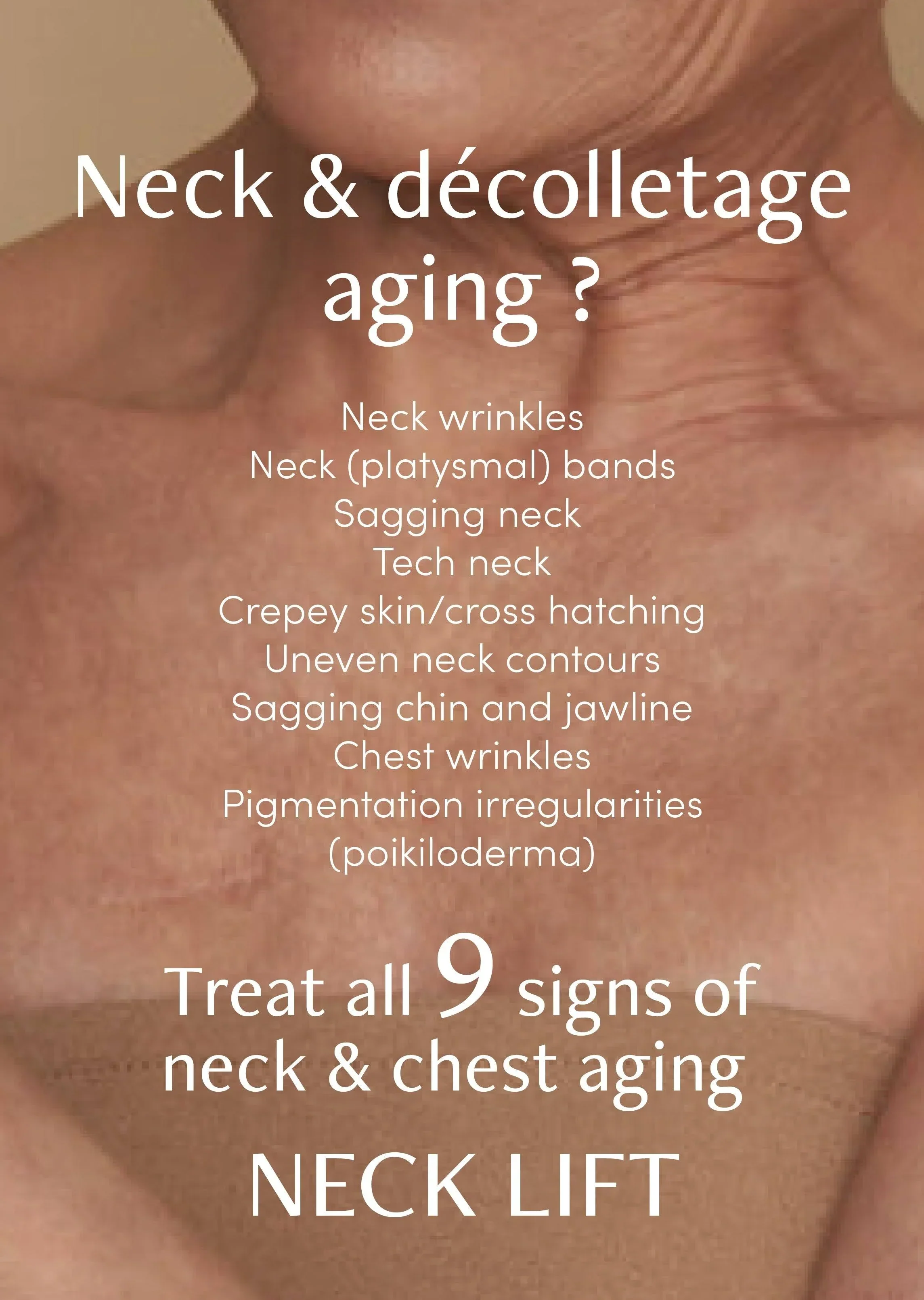 freezeframe Neck Lift 50ml - Image 9