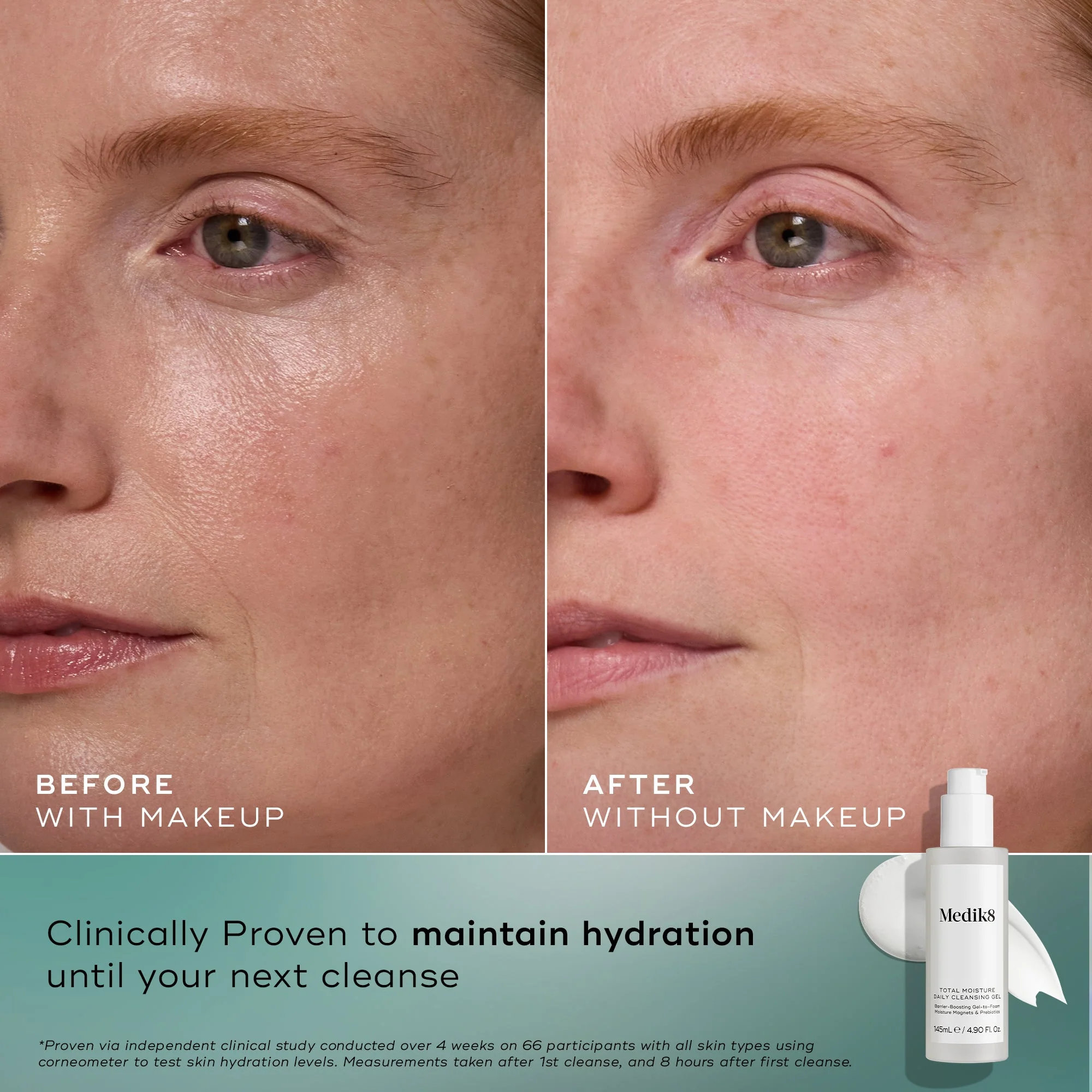 Medik8 Total Moisture Daily Cleansing Gel 145ml - Image 4