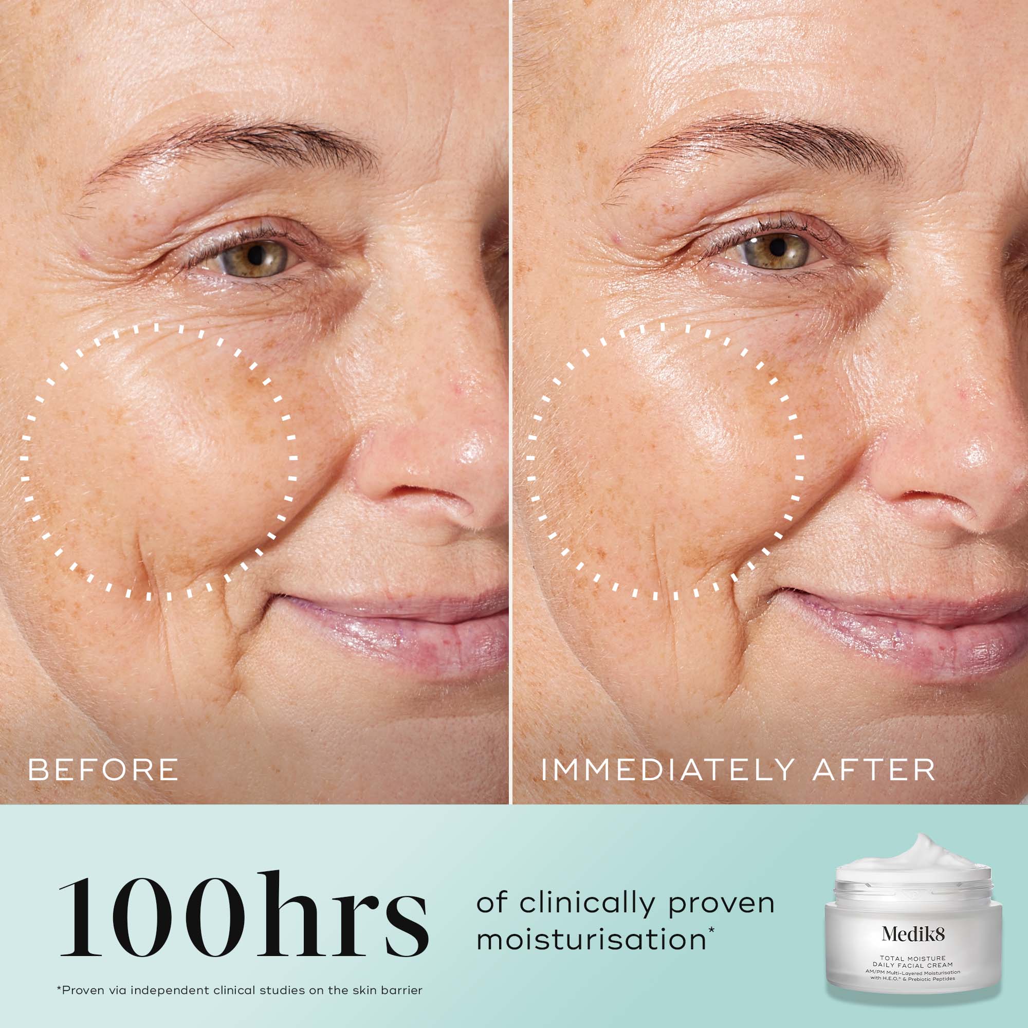 Medik8 Total Moisture Daily Facial Cream 50ml - Image 3
