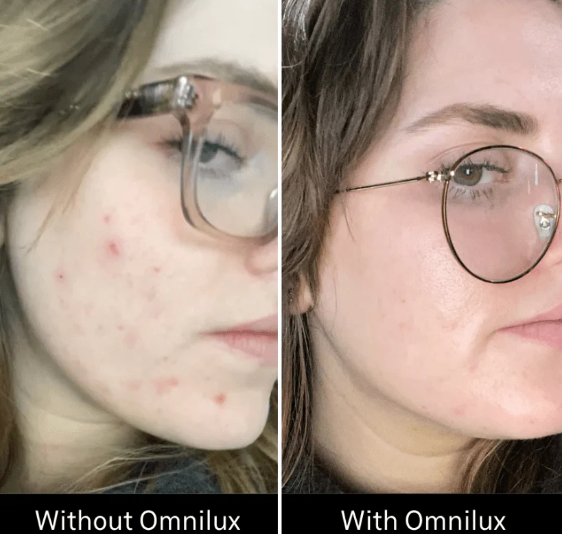 Omnilux Clear - Image 11