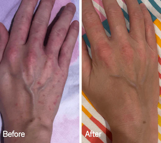 Omnilux Contour Glove - Image 12