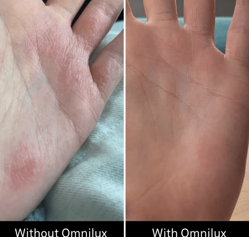 Omnilux Contour Glove - Image 7