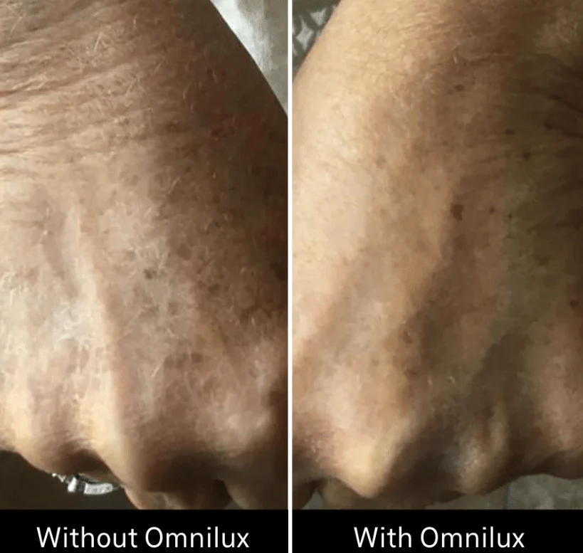 Omnilux Contour Glove - Image 8