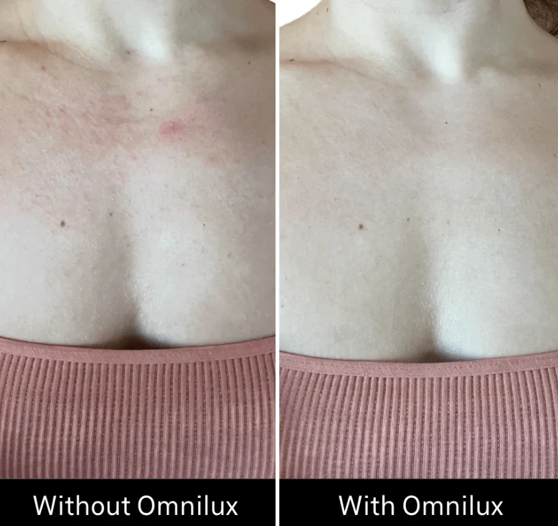 Omnilux Contour Neck & Décolleté - Image 12