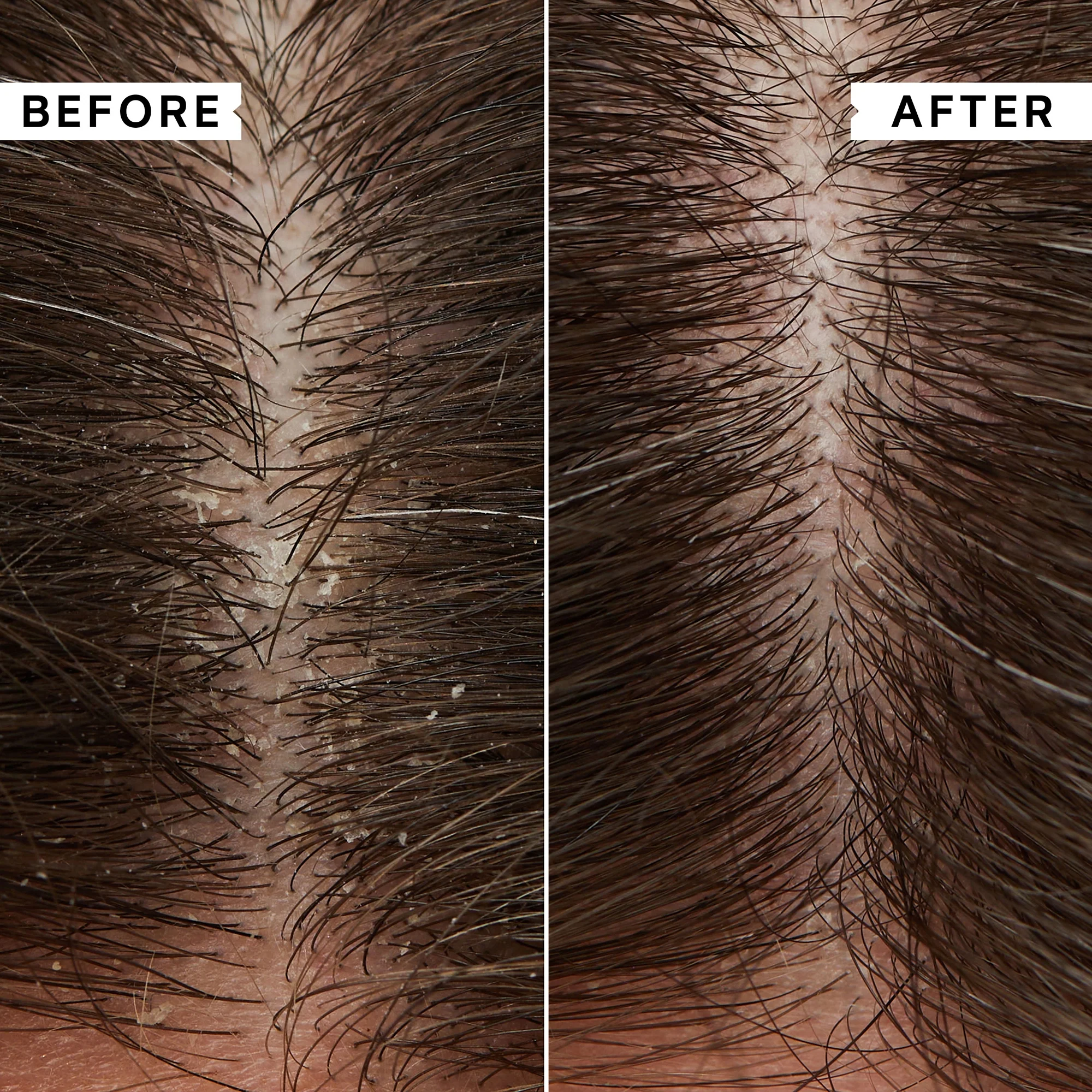 Philip KingsleyFlaky/Itchy Scalp Anti-Dandruff Scalp Toner 250ml - Image 2