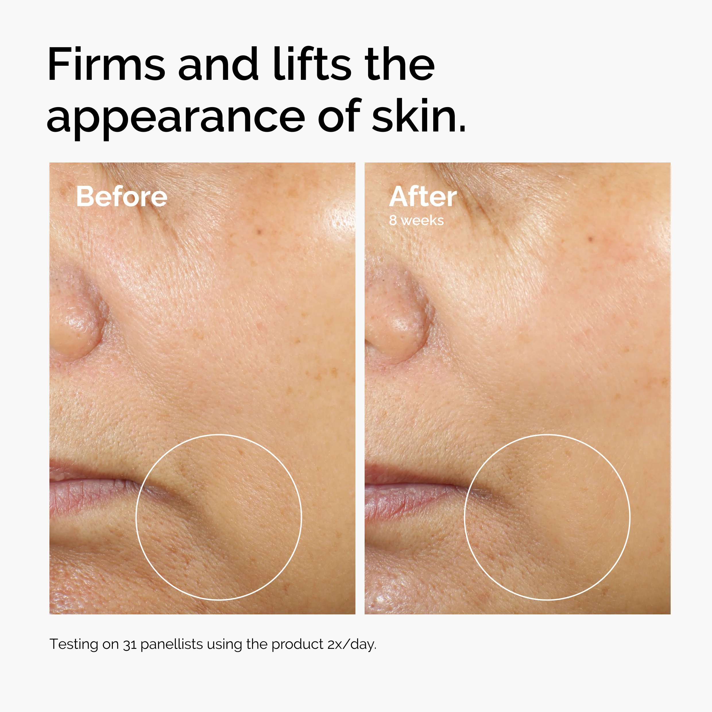 The Ordinary Caffeine 3% + Escin 1% Face Serum 30ml  - Image 7