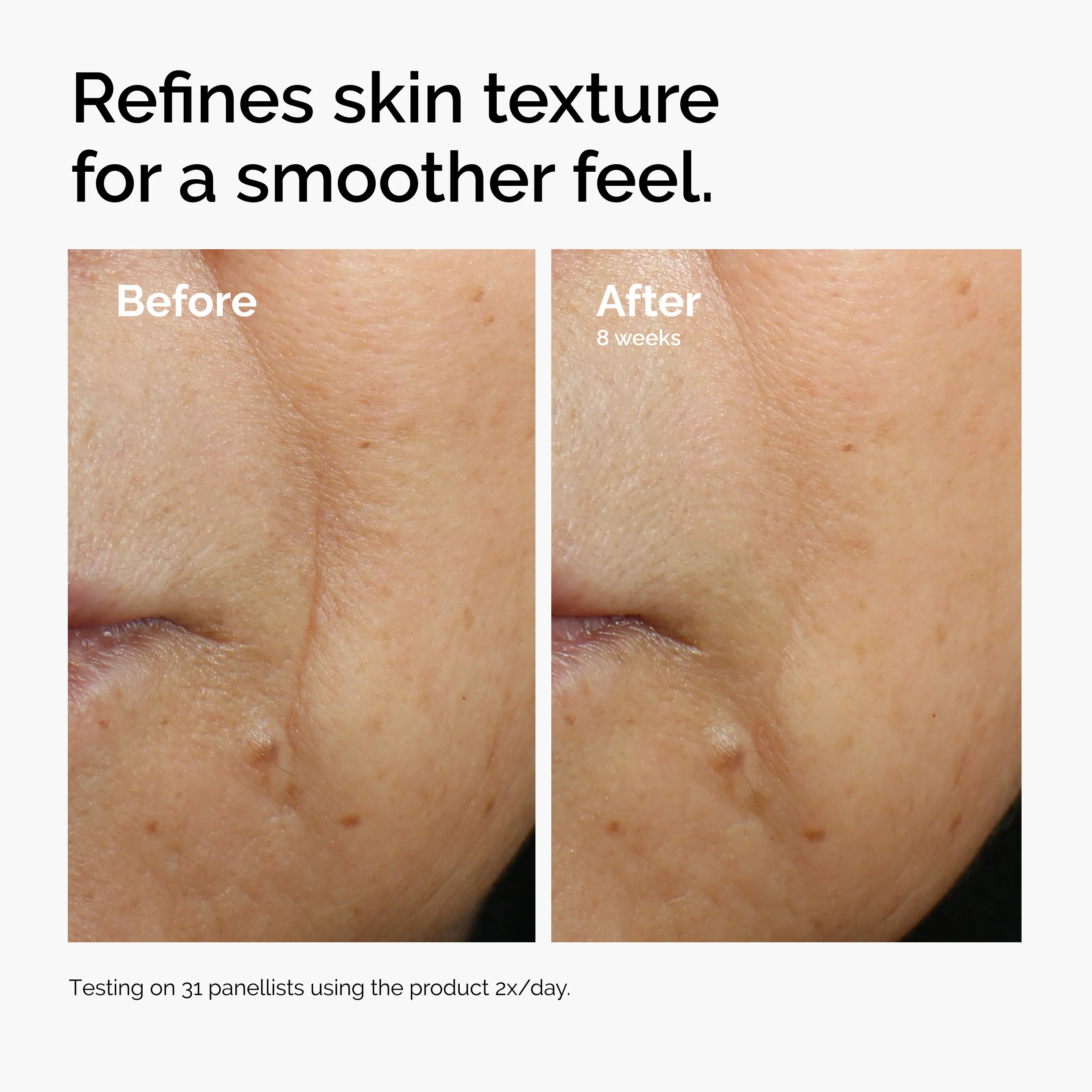 The Ordinary Caffeine 3% + Escin 1% Face Serum 30ml  - Image 9