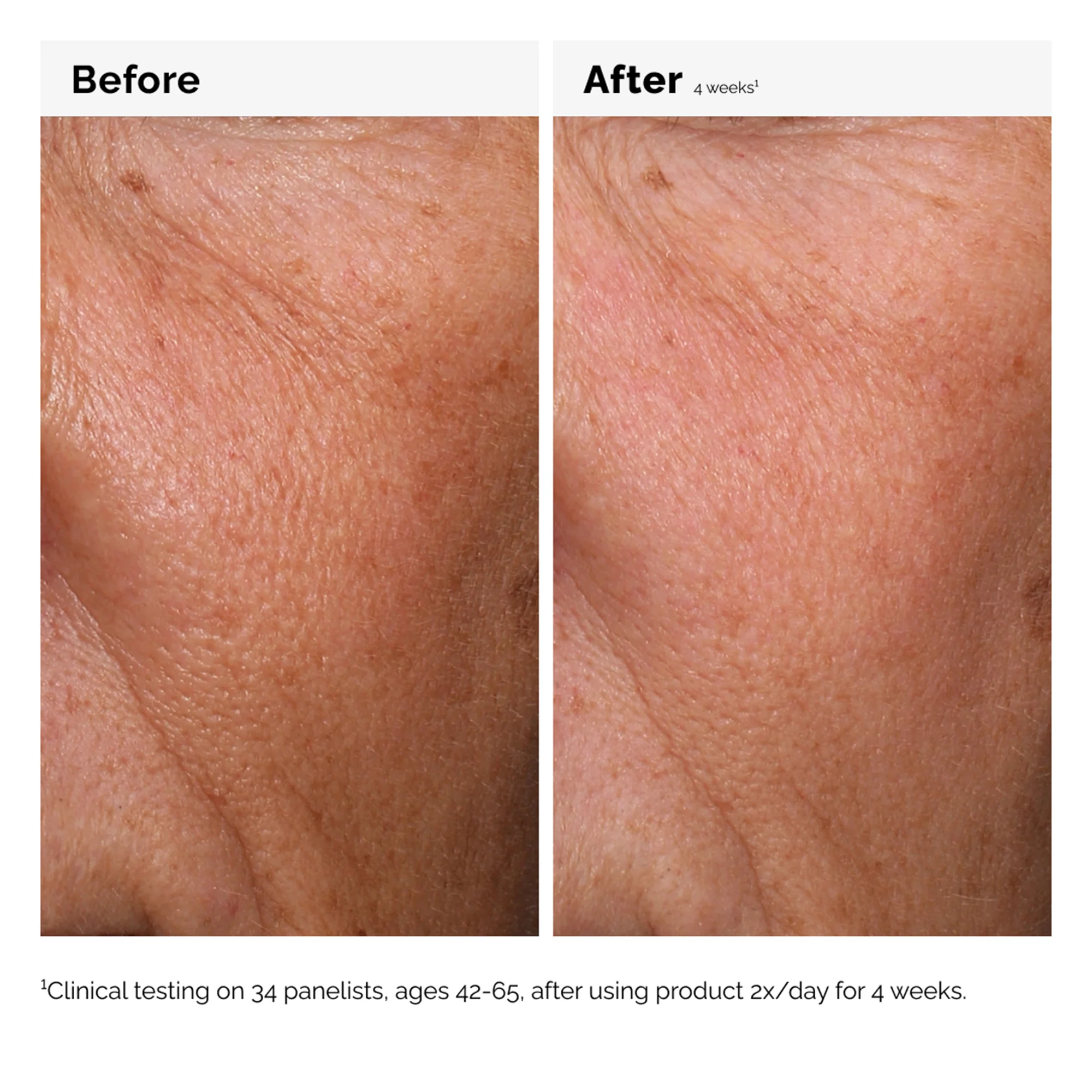 The Ordinary Hyaluronic Acid 2% + B5 60ml - Image 5