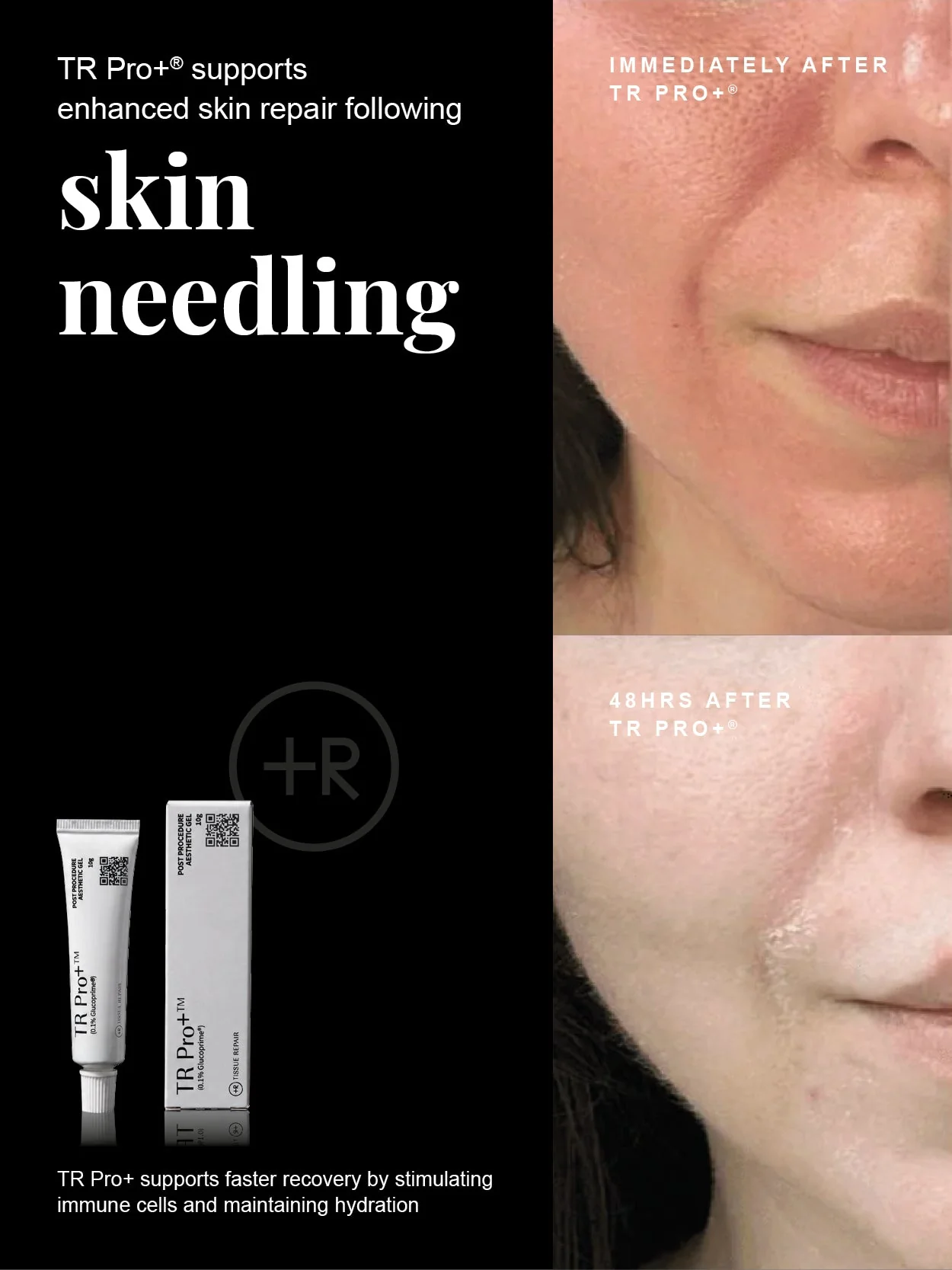 TR Pro+ Tissue Repair Hydrogel 10g - Image 4