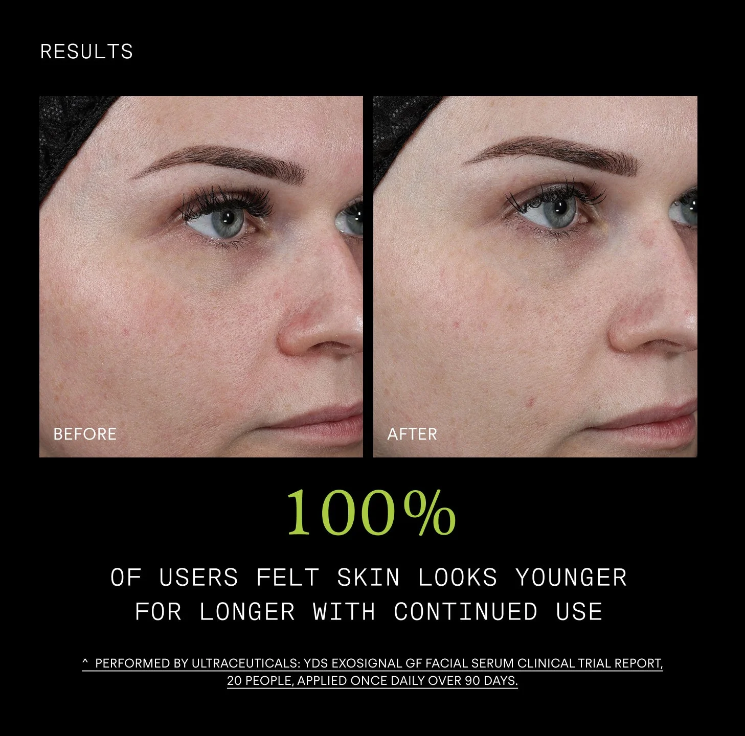 Ultraceuticals Youth Booth ExoSignal GF² Facial Serum 30mL - Image 7